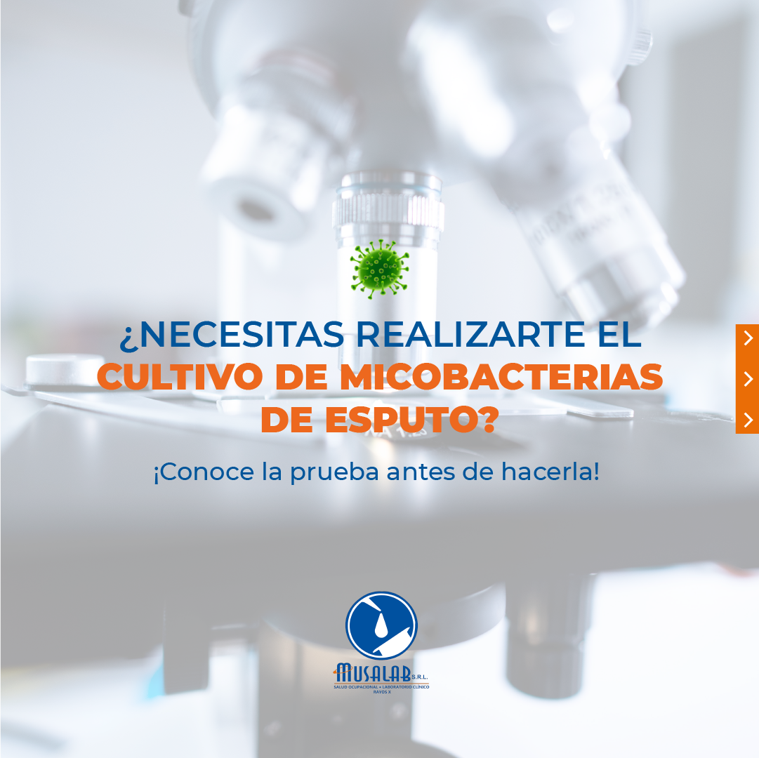 Slide30